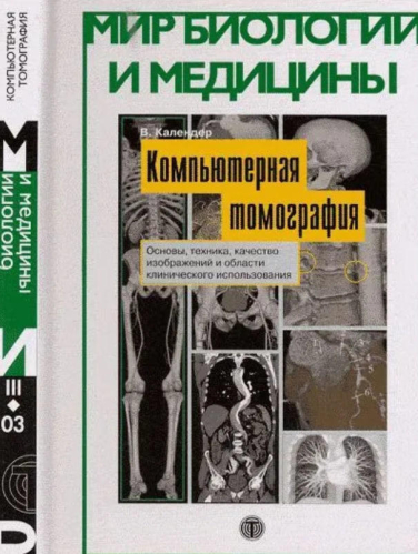 Компьютерная томография. Основы, техника, качество изображений и области клинического использования  (уценка, витринный экз.)